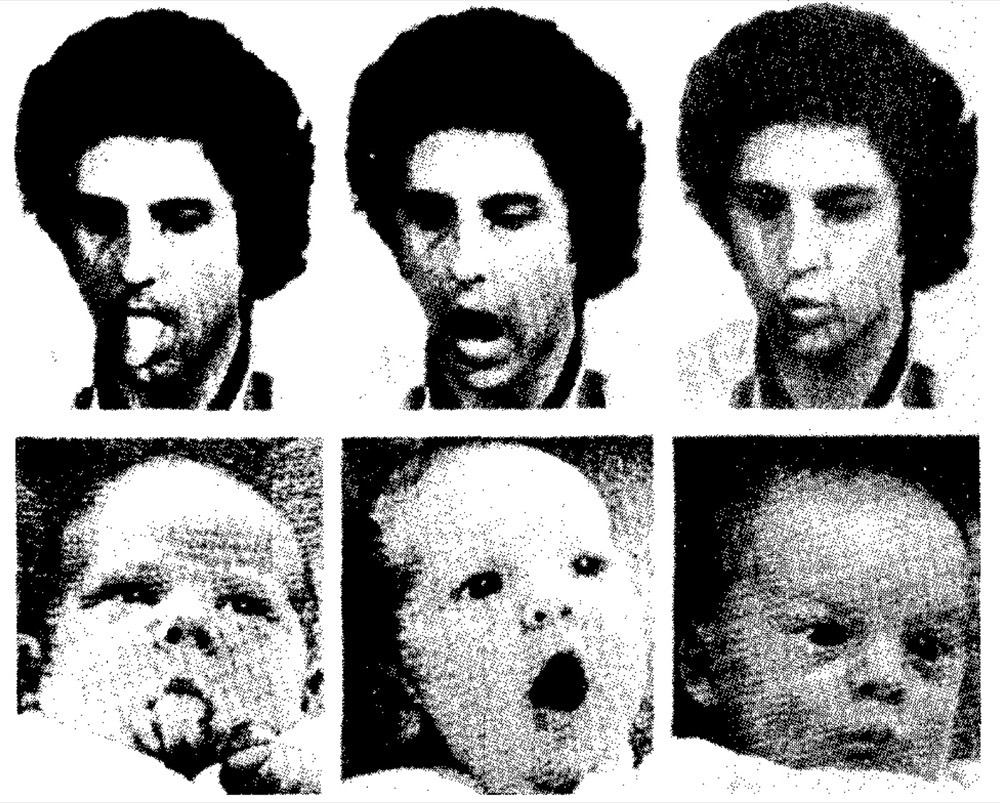 新生児の模倣行動研究（メルツォフとムーアによる、生後 42 分〜72 時間の乳児が大人の表情を模倣する様子）